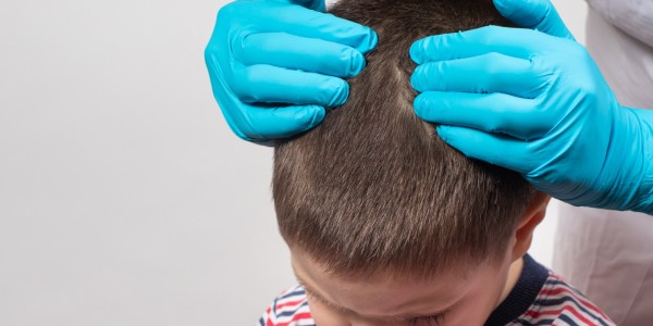 Powracająca wszawica w przedszkolu – przyczyny, profilaktyka i skuteczne rozwiązania dla rodziców