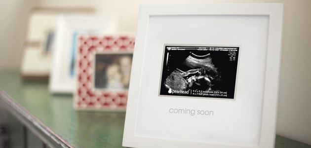Badanie USG w ciąży - moment, który pamięta się na zawsze